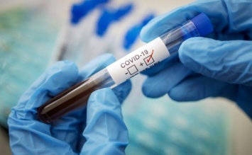 Украинцев обманывают с тестами на коронавирус: врач раскрыл скандальные детали