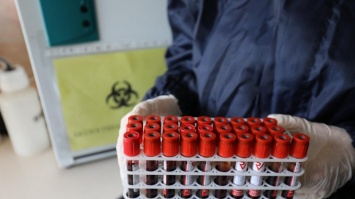 Ученые назвали факторы, которые резко увеличивают риск смерти от коронавируса
