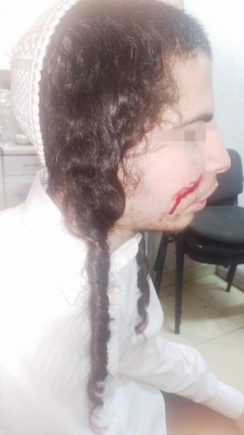 В Умани неизвестные напали с ножом на хасидов-подростков. Фото