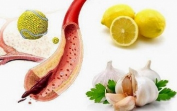 Эти 10 продуктов отлично очищают артерии