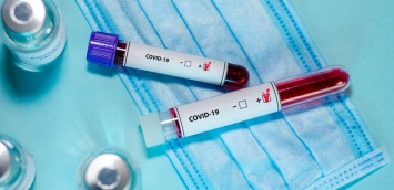 В Запорожской области выявили 681 заболевшего коронавирусом, среди них - 58 медиков
