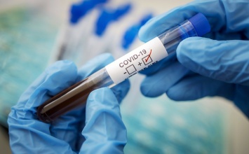 Коронавирус в Днепре: где сдать ПРЦ, тест на антитела и сколько это стоит