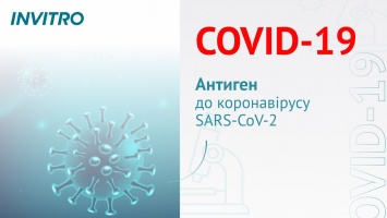 В Днепре Инвитро запускает современные тесты на Covid-19 и существенное снижение цен для тестирования на коронавирус