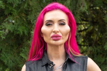 Украинская блогерша с аномально круглыми щеками показала фото до пластики лица