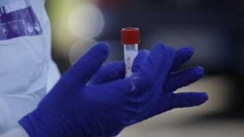 78 случаев за двое суток и новая смерть от коронавируса - обновленные данные