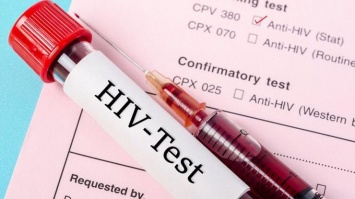 ТОП-5 заблуждений о ВИЧ и СПИДе