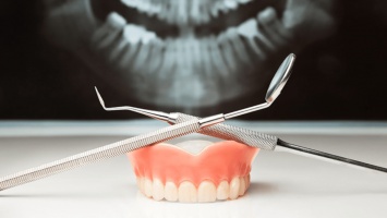 Удалять или сохранять зубы: показания и противопоказания
