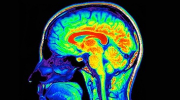 Ученые придумали, как омолодить мозг