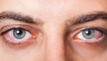 Ученые назвали «глазные симптомы» коронавируса
