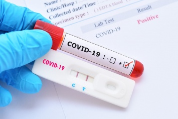 В Германии впервые обнаружили новую мутацию коронавируса из Бразилии