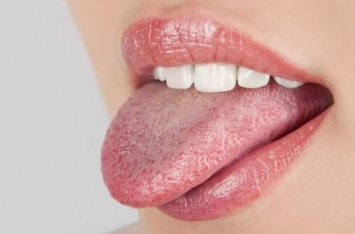 Бюллетень здоровья: что об организме расскажет цвет вашего языка