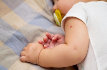 Из роддомов выписывают без БЦЖ: в Украине закончилась вакцина от туберкулеза