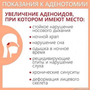 Доктор Комаровский объяснил, при каких симптомах нужно удалять аденоиды