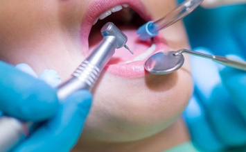 Перечень стоматологических услуг, которые днепряне в 2021 году смогут получить бесплатно