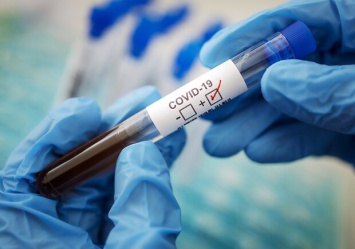 Умерли еще 8 человек: какая ситуация с коронавирусом в Днепре на 19 февраля