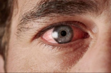 Названы лекарственные препараты, вызывающие синдром сухого глаза