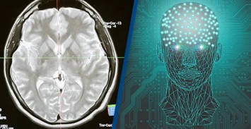 Ученые впервые в истории подключили человеческий мозг к компьютеру по беспроводной сети