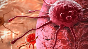 Борьба со смертью: разработана уникальная технология "убийства" рака