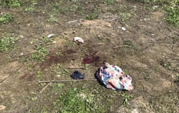 Найденное в Киеве тело в сумке: появились новые подробности