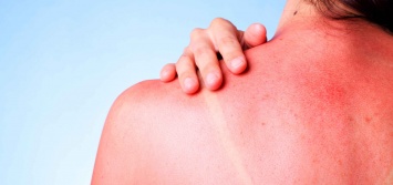 Аллергия на солнце: она же фотодерматит