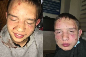 В центре Днепра неизвестные избили троих подростков: фото, видео