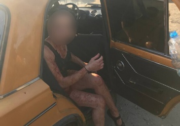Вся в крови: в Днепре жестоко избили женщину и затащили в авто