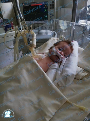 В реанимации Днепра спасают 3-месячного малыша с тяжелой пневмонией