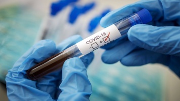 В Запорожской области растет число инфицированных коронавирусом