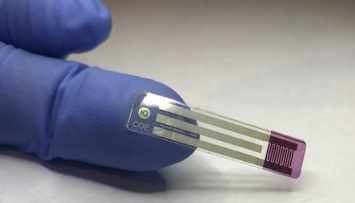 Больше никакой крови: ученые разработали новый безболезненный тест для диабетиков