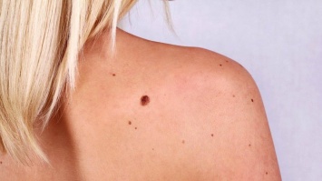 Ученые сделали шокирующее заявление о раке кожи