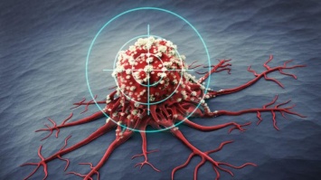 Война со смертью: медики феноменально победили рак груди