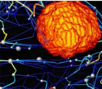 Рак мозга: ученые в шаге от виртуальных операций