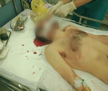 На Киевщине порезали ножом таксиста: мужчина в реанимации