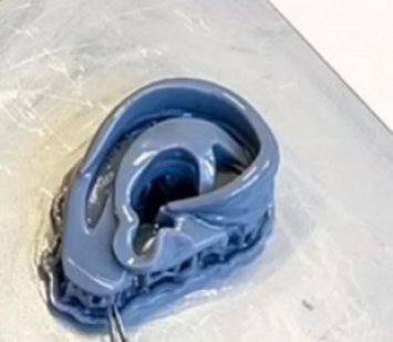 Ученые напечатали на 3D-принтере человеческое ухо