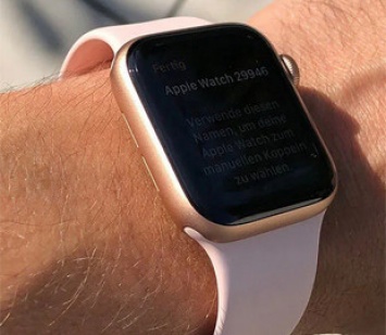 Apple Watch спасли жизнь владелице