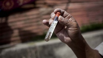 Moderna разработала вакцину против ВИЧ, начинает испытания