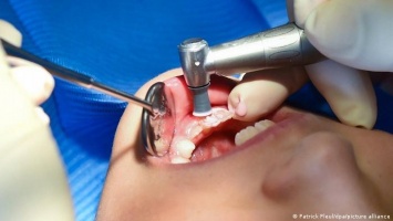 Немецкие стоматологи в шоке: у каждого третьего ребенка - проблемы с эмалью