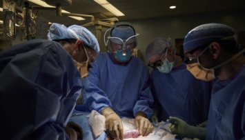 В США впервые успешно пересадили человеку почку, выращенную в теле свиньиопе