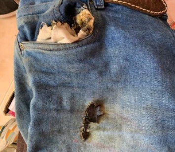 Из-за взрыва смартфона OnePlus мужчина получил страшные ожоги