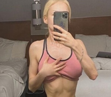 Одесская Барби довела себя до анорексии: 38 килограмм
