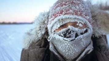 В Киев вернулись морозы: как оказать первую помощь при обморожении