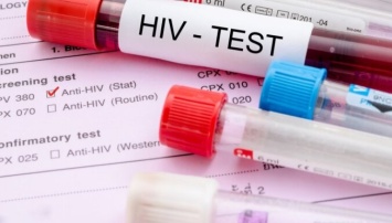 В Нидерландах выявлен новый, более опасный вариант ВИЧ