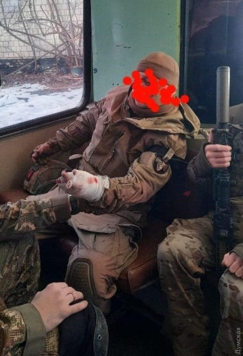 В Одессе во время занятий офицер-сапер получил травму руки: пострадавшему оказали помощь, но дело собирались замять